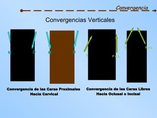 Convergencia Convergencia de las Caras Proximales  Hacia Cervical Convergencia de las Caras Libres Hacia Oclusal o Incisal Convergencias Verticales M D M D V P o L V P o L 