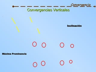 Convergencia Convergencias Verticales Máxima Prominencia Inclinación 