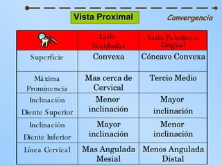 Vista Proximal   Convergencia Menos Angulada Distal Mas Angulada Mesial Línea Cervical Menor  inclinación Mayor inclinación Inclinación Diente Inferior Mayor  inclinación Menor  inclinación Inclinación Diente Superior Tercio Medio Mas cerca de Cervical Máxima Prominencia Cóncavo Convexa Convexa Superficie Lado Palatino o Lingual Lado  Vestibular 