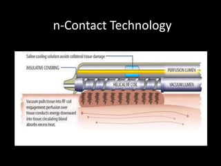 n-Contact Technology
 
