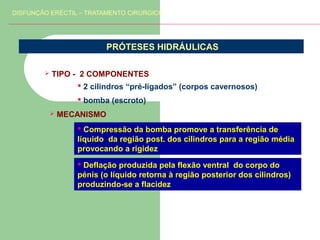 DISFUNÇÃO ERÉCTIL – TRATAMENTO CIRÚRGICO

PRÓTESES HIDRÁULICAS


TIPO - 2 COMPONENTES
 2 cilindros “pré-ligados” (corpos cavernosos)
 bomba (escroto)


MECANISMO
 Compressão da bomba promove a transferência de
líquido da região post. dos cilindros para a região média
provocando a rigidez
 Deflação produzida pela flexão ventral do corpo do
pénis (o líquido retorna à região posterior dos cilindros)
produzindo-se a flacidez

 