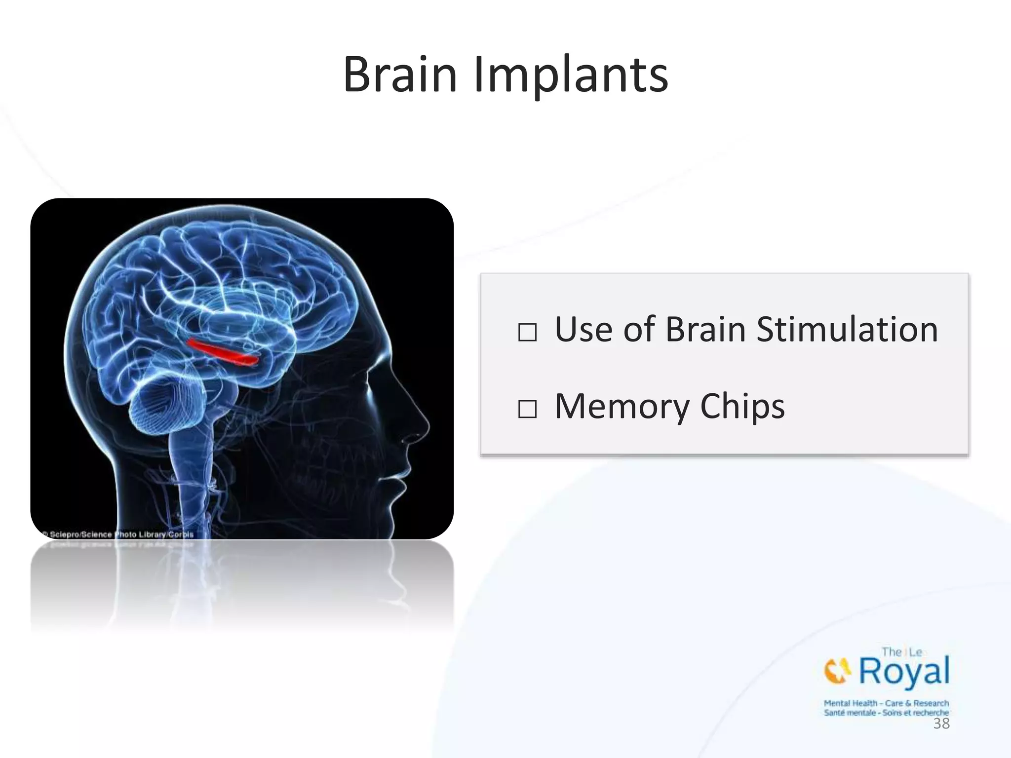 □ Use of Brain Stimulation
□ Memory Chips
38
Brain Implants
 