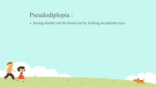 Pseudodiplopia :
 Seeing double can be found out by looking at patients eyes.
 
