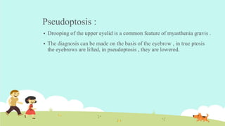 Pseudoptosis :
 Drooping of the upper eyelid is a common feature of myasthenia gravis .
 The diagnosis can be made on the basis of the eyebrow , in true ptosis
the eyebrows are lifted, in pseudoptosis , they are lowered.
 