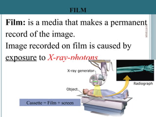 Conventional Radiography Screen Explanations for conventional radiography specifically screen film ...