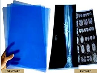 Conventional Radiography Screen Explanations for conventional radiography specifically screen film ...