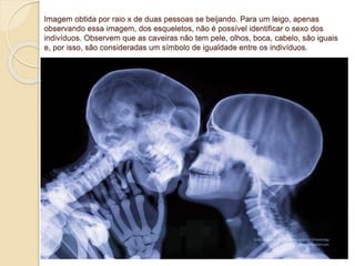 Imagem obtida por raio x de duas pessoas se beijando. Para um leigo, apenas
observando essa imagem, dos esqueletos, não é possível identificar o sexo dos
indivíduos. Observem que as caveiras não tem pele, olhos, boca, cabelo, são iguais
e, por isso, são consideradas um símbolo de igualdade entre os indivíduos.
 
