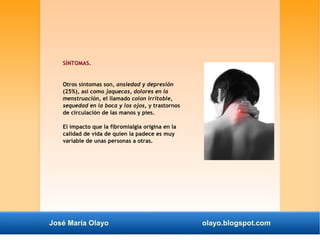 SÍNTOMAS. 
Otros síntomas son, ansiedad y depresión 
(25%), así como jaquecas, dolores en la 
menstruación, el llamado colon irritable, 
sequedad en la boca y los ojos, y trastornos 
de circulación de las manos y pies. 
El impacto que la fibromialgia origina en la 
calidad de vida de quien la padece es muy 
variable de unas personas a otras. 
José María Olayo olayo.blogspot.com 
 