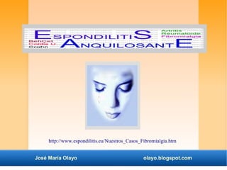 http://www.espondilitis.eu/Nuestros_Casos_Fibromialgia.htm 
José María Olayo olayo.blogspot.com 
 