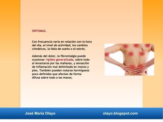 SÍNTOMAS. 
Con frecuencia varía en relación con la hora 
del día, el nivel de actividad, los cambios 
climáticos, la falta de sueño o el estrés. 
Además del dolor, la fibromialgia puede 
ocasionar rigidez generalizada, sobre todo 
al levantarse por las mañanas, y sensación 
de inflamación mal delimitada en manos y 
pies. También pueden notarse hormigueos 
poco definidos que afectan de forma 
difusa sobre todo a las manos. 
José María Olayo olayo.blogspot.com 
 