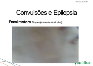 Convulsões e Epilepsia Prof. Me PostGrad Romano, Leandro
Convulsões e Epilepsia
Focalmotora Simples (somente mioclonias);
 