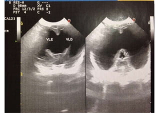 Convulsões e Epilepsia Prof. Me PostGrad Romano, Leandro
 