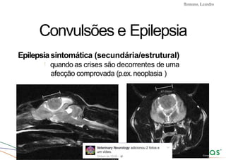 Convulsões e Epilepsia Prof. Me PostGrad Romano, Leandro
Convulsões e Epilepsia
Epilepsiasintomática (secundária/estrutural)
! quando as crises são decorrentes de uma
afecção comprovada (p.ex.neoplasia )
 