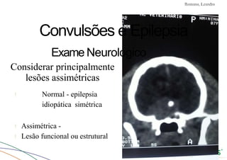 Convulsões e Epilepsia Prof. Me PostGrad Romano, Leandro
Convulsões e Epilepsia
Exame Neurológico
Considerar principalmente
lesões assimétricas
! Normal - epilepsia
idiopática simétrica
! Assimétrica -
! Lesão funcional ou estrutural
 