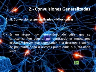 2.- Convulsiones Generalizadas

2.- E. Convulsiones generalizadas – Mioclonicas:



• Es un grupo muy heterogéneo de crisis, que se
  caracterizan en general por contracciones musculares
  bruscas y breves que acompañan a la descarga bilateral
  de poli-punta-onda o a veces punta-onda o punta-onda
  lenta.
 
