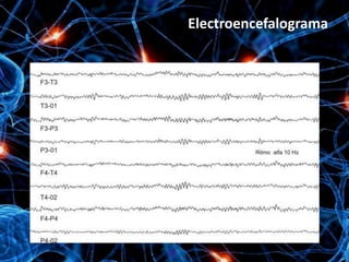 Electroencefalograma
 