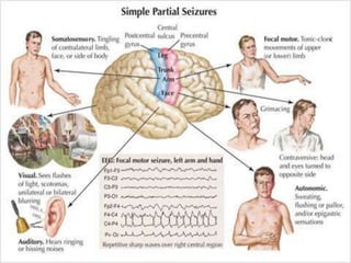 pediatric convulsion | PPTX