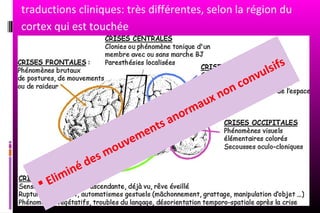 traductions cliniques: très différentes, selon la région du
cortex qui est touchée


                                                                             ul sifs
                                                                         o nv
                                                                 no nc
                                                          a ux
                                                 an orm
                                         en ts
                                 uv em
                          s mo
                   é de
           im in
     El
 