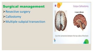 Surgical management
Resective surgery
Callostomy
Multiple subpial transection
 