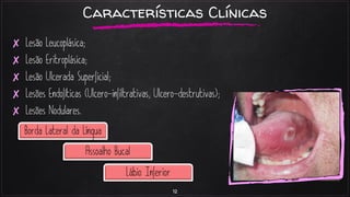 12
✘
✘
✘
✘
✘
Características Clínicas
 