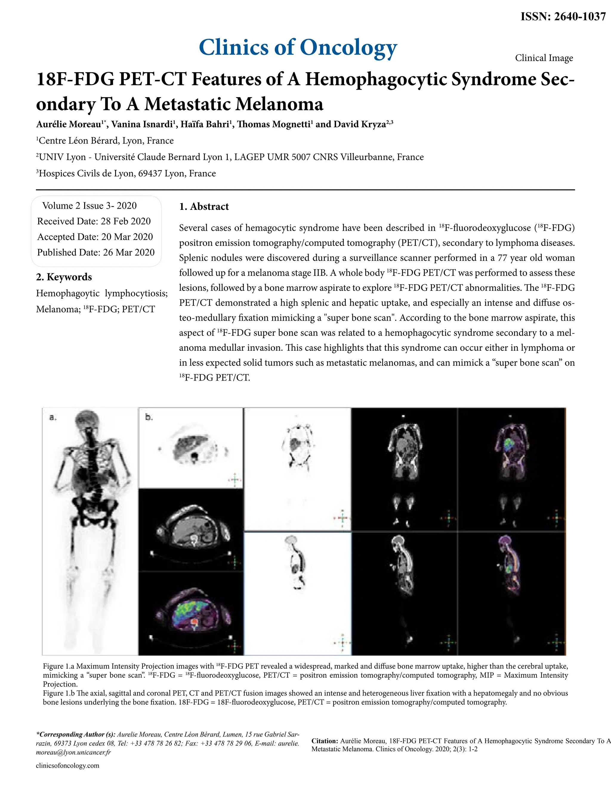 18F-FDG PET-CT Features of A Hemophagocytic Syndrome Secondary To A ...