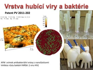 AFM snmek antibakteriln vrstvy s nano?sticemi
Inhibice r?stu baktri MRSA (i viru HIV)
Patent PV 2011-202
 