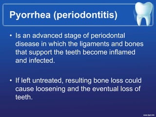 • Is an advanced stage of periodontal
disease in which the ligaments and bones
that support the teeth become inflamed
and infected.
• If left untreated, resulting bone loss could
cause loosening and the eventual loss of
teeth.
Pyorrhea (periodontitis)
 
