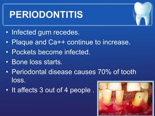 PERIODONTITIS
• Infected gum recedes.
• Plaque and Ca++ continue to increase.
• Pockets become infected.
• Bone loss starts.
• Periodontal disease causes 70% of tooth
loss.
• It affects 3 out of 4 people .
 