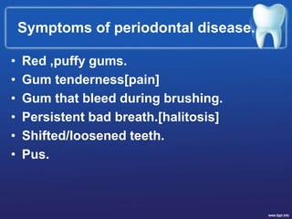 Symptoms of periodontal disease.
• Red ,puffy gums.
• Gum tenderness[pain]
• Gum that bleed during brushing.
• Persistent bad breath.[halitosis]
• Shifted/loosened teeth.
• Pus.
 