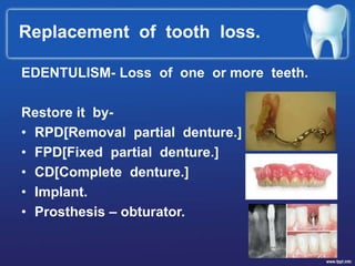 Replacement of tooth loss.
EDENTULISM- Loss of one or more teeth.
Restore it by-
• RPD[Removal partial denture.]
• FPD[Fixed partial denture.]
• CD[Complete denture.]
• Implant.
• Prosthesis – obturator.
 
