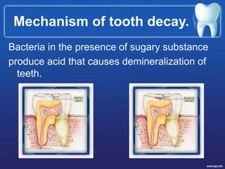 Mechanism of tooth decay.
Bacteria in the presence of sugary substance
produce acid that causes demineralization of
teeth.
 