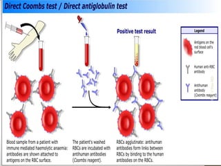 Coombstest | PDF