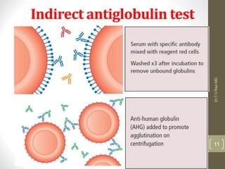 COOMBS TEST.ppt