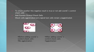 COOMBS TEST direct and indirect coombs antisera.pptx