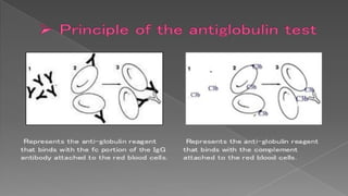 COOMBS TEST direct and indirect coombs antisera.pptx