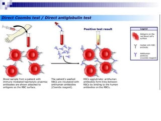 Coombs test and eliza