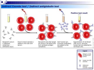 Coombs test and eliza