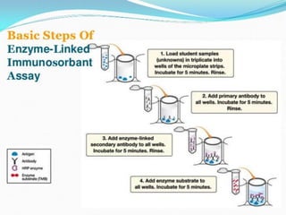 Coombs test and eliza