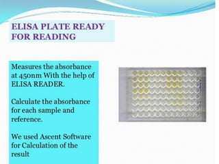 Coombs test and eliza