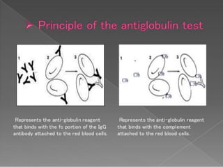 Coombs test and eliza
