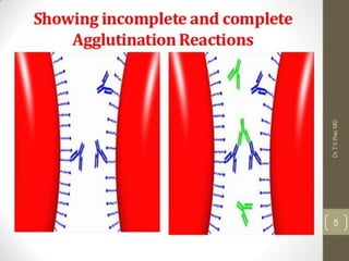 Coombs test and eliza