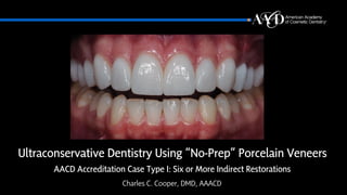 Ultraconservative Dentistry Using “No-Prep” Porcelain Veneers
AACD Accreditation Case Type I: Six or More Indirect Restorations
Charles C. Cooper, DMD, AAACD
 