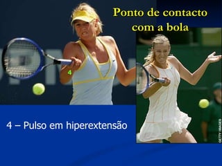 4 – Pulso em hiperextensão Ponto de contacto com a bola 4 