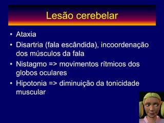 Lesão cerebelar
• Ataxia
• Disartria (fala escândida), incoordenação
dos músculos da fala
• Nistagmo => movimentos rítmicos dos
globos oculares
• Hipotonia => diminuição da tonicidade
muscular
 