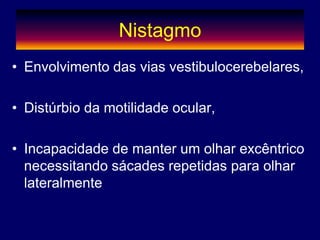 Nistagmo
• Envolvimento das vias vestibulocerebelares,
• Distúrbio da motilidade ocular,
• Incapacidade de manter um olhar excêntrico
necessitando sácades repetidas para olhar
lateralmente
 