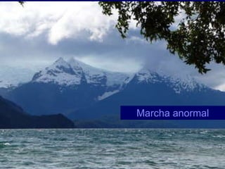 Marcha anormal 