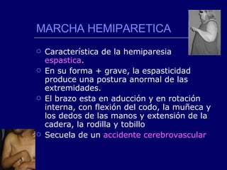 MARCHA HEMIPARETICA Característica de la hemiparesia  espastica . En su forma + grave, la espasticidad produce una postura anormal de las extremidades. El brazo esta en aducción y en rotación interna, con flexión del codo, la muñeca y los dedos de las manos y extensión de la cadera, la rodilla y tobillo Secuela de un  accidente cerebrovascular 