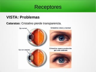 Receptores
VISTA: Problemas
Cataratas: Cristalino pierde transparencia.
 