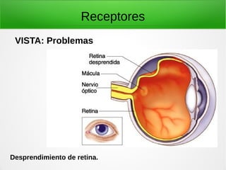 Receptores
VISTA: Problemas
Desprendimiento de retina.
 