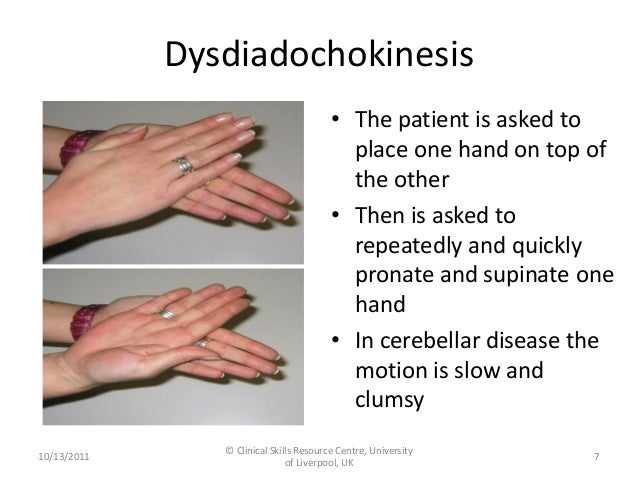 eye test hand coordination Exam Coordination